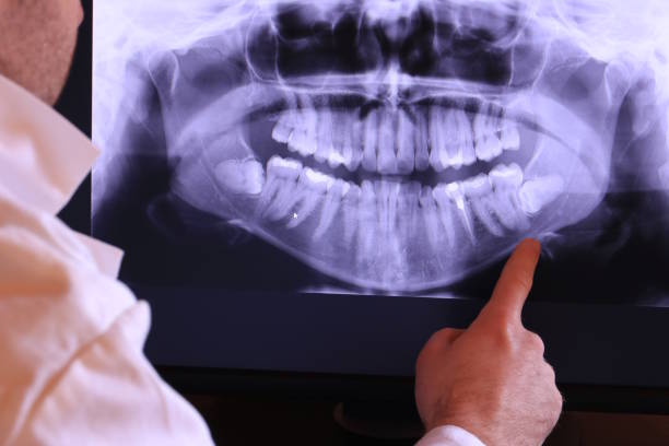 Best Dentist for Tooth Abscess  in Camano, WA
