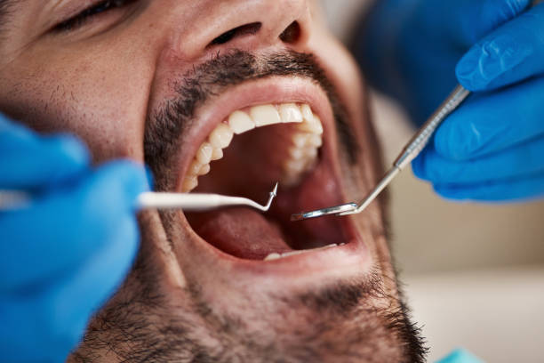 Best Cracked Tooth Emergency Dentist  in Camano, WA