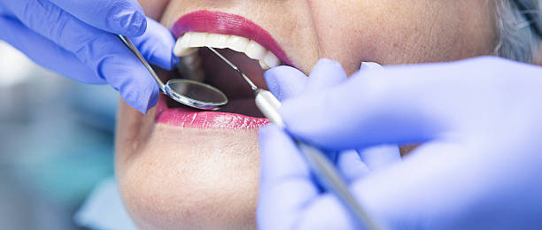 Best Urgent Tooth Repair  in Camano, WA